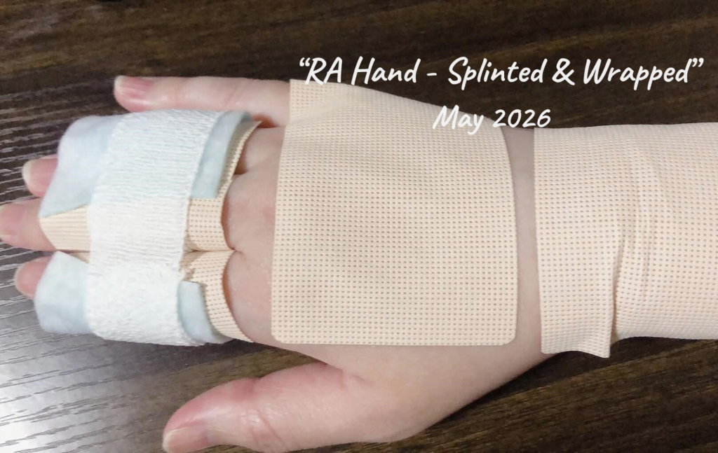 RAhand2-1024x647 体の中で何かが入れ替わった｜AIとくぐり抜けた、関節リウマチとコロナ後遺症パロスミアの1ヶ月